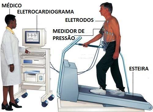Avaliação Cardiológica em Praticantes de Atividade Física
